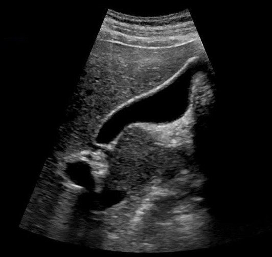 Abdominal parameter ultrasound