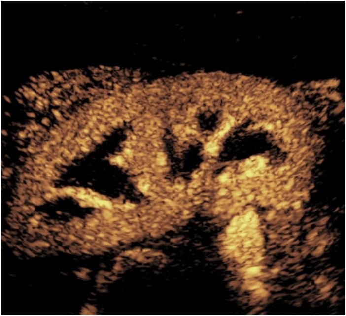 Case challenges ultrasound image