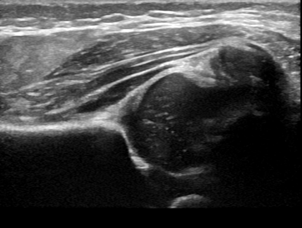 AIUM Ultrasound Practice Parameters