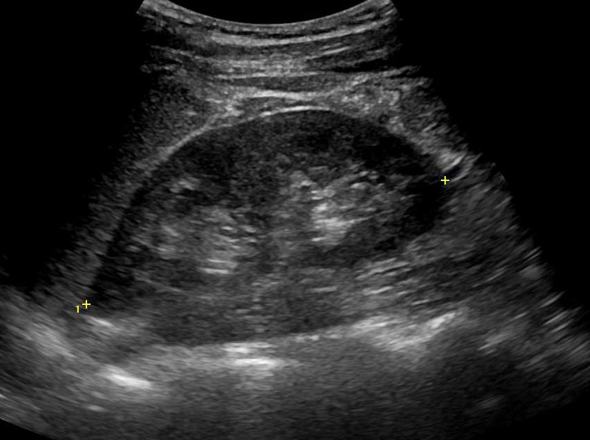 Kidney and urology practice parameter ultrasound image