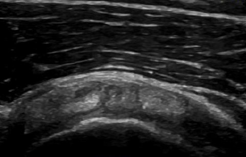 Musculoskeletal ultrasound website image