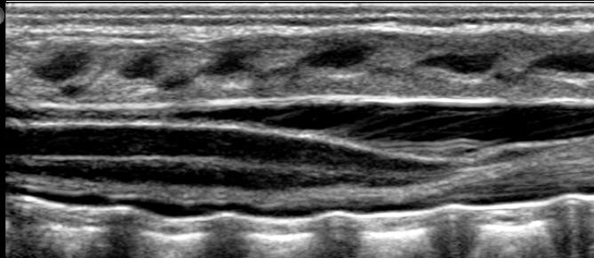 Neonatal ultrasound image