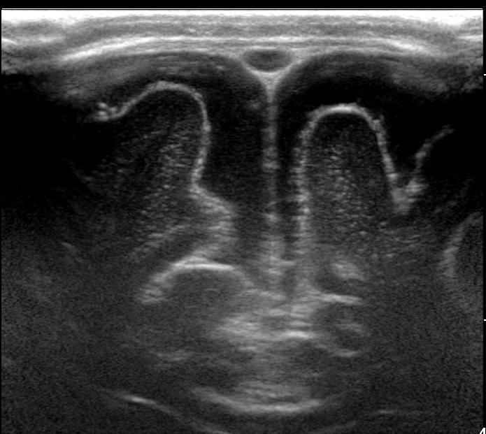 Neurology parameter ultrasound image