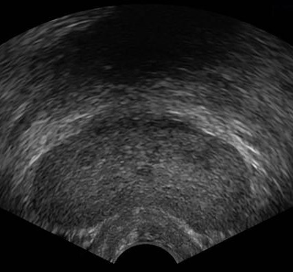 AIUM Ultrasound Practice Parameters