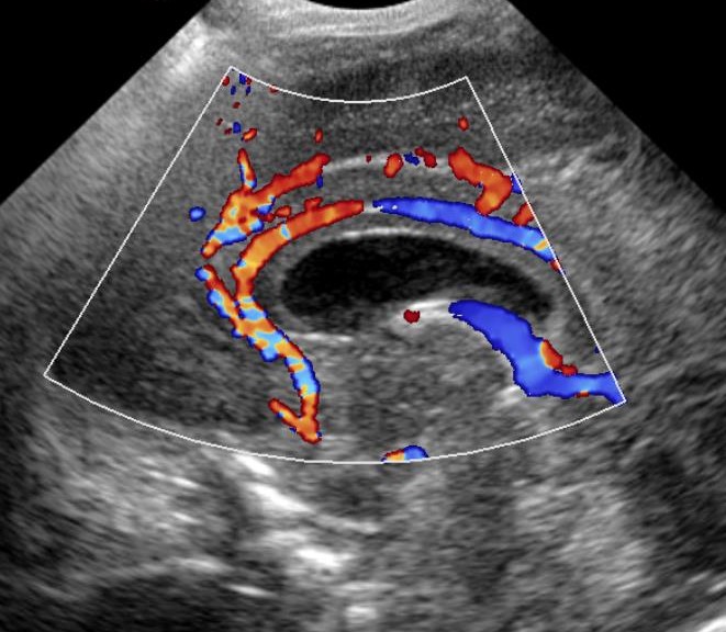 Transcranial Doppler ultrasound parameter image