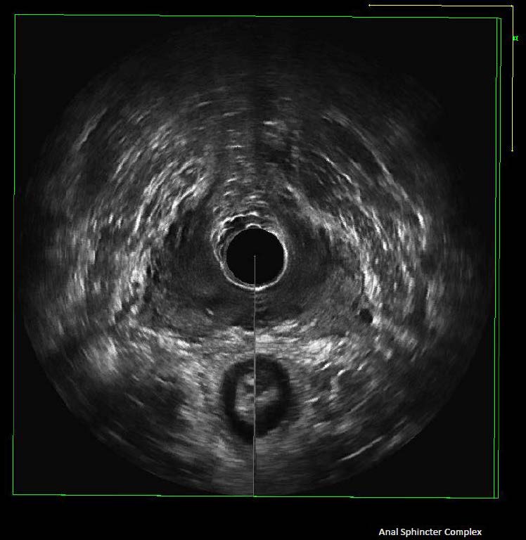 AIUM Ultrasound Practice Parameters